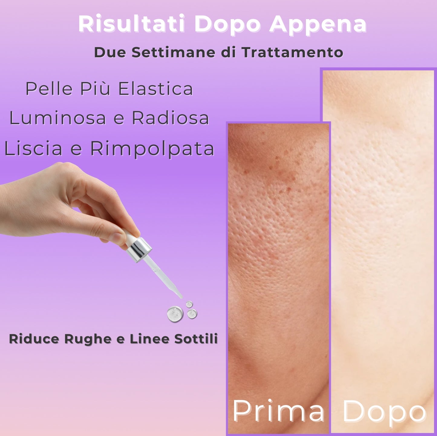 Siero viso ai 5 acidi ialuronici